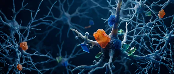 Brain Microplastics: 5 Ways They Trigger Alzheimer's & Dementia